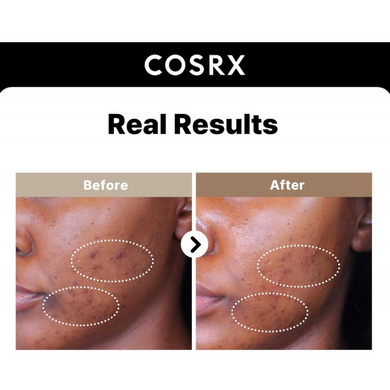 Фото Сироватка для обличчя CosRX The Alpha-Arbutin2 Discoloration Care Serum, 50ml The Alpha-Arbutin2 Discoloration