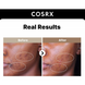 Сироватка для обличчя CosRX The Alpha-Arbutin2 Discoloration Care Serum, 50ml
