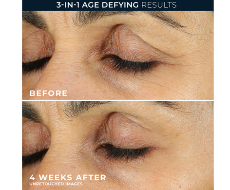 Фото Крем для коррекции кожи под глазами RoC Retinol Correxion, 15 мл Retinol Correxion