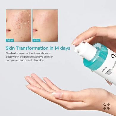 Фото Тонер для обличчя із саліциловою кислотою Anua BHA 2% Gentle Exfoliating Toner 150 мл BHA 2%